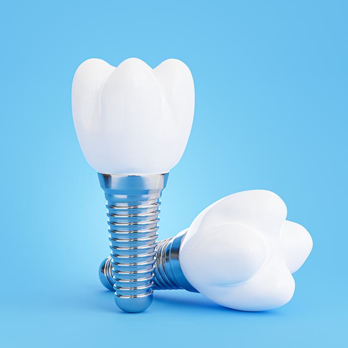 Two dental implants with dental crowns