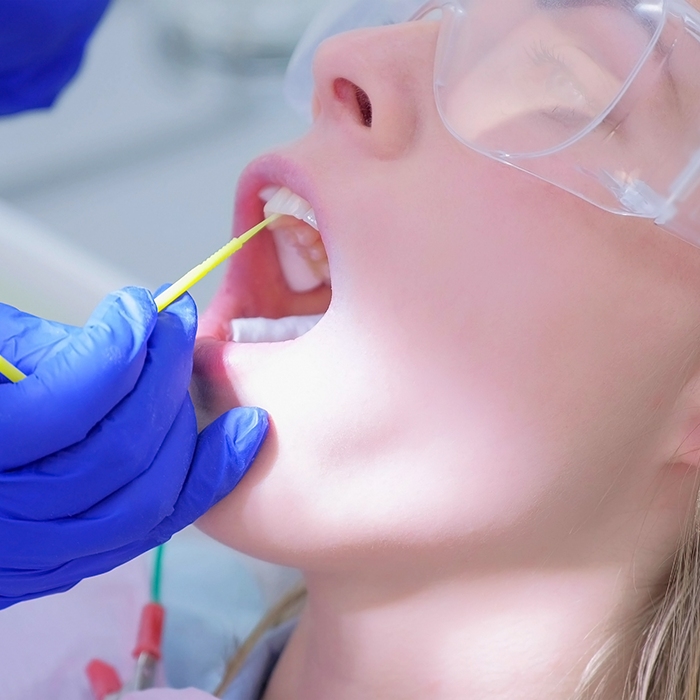 Dental patient having fluoride applied to their teeth